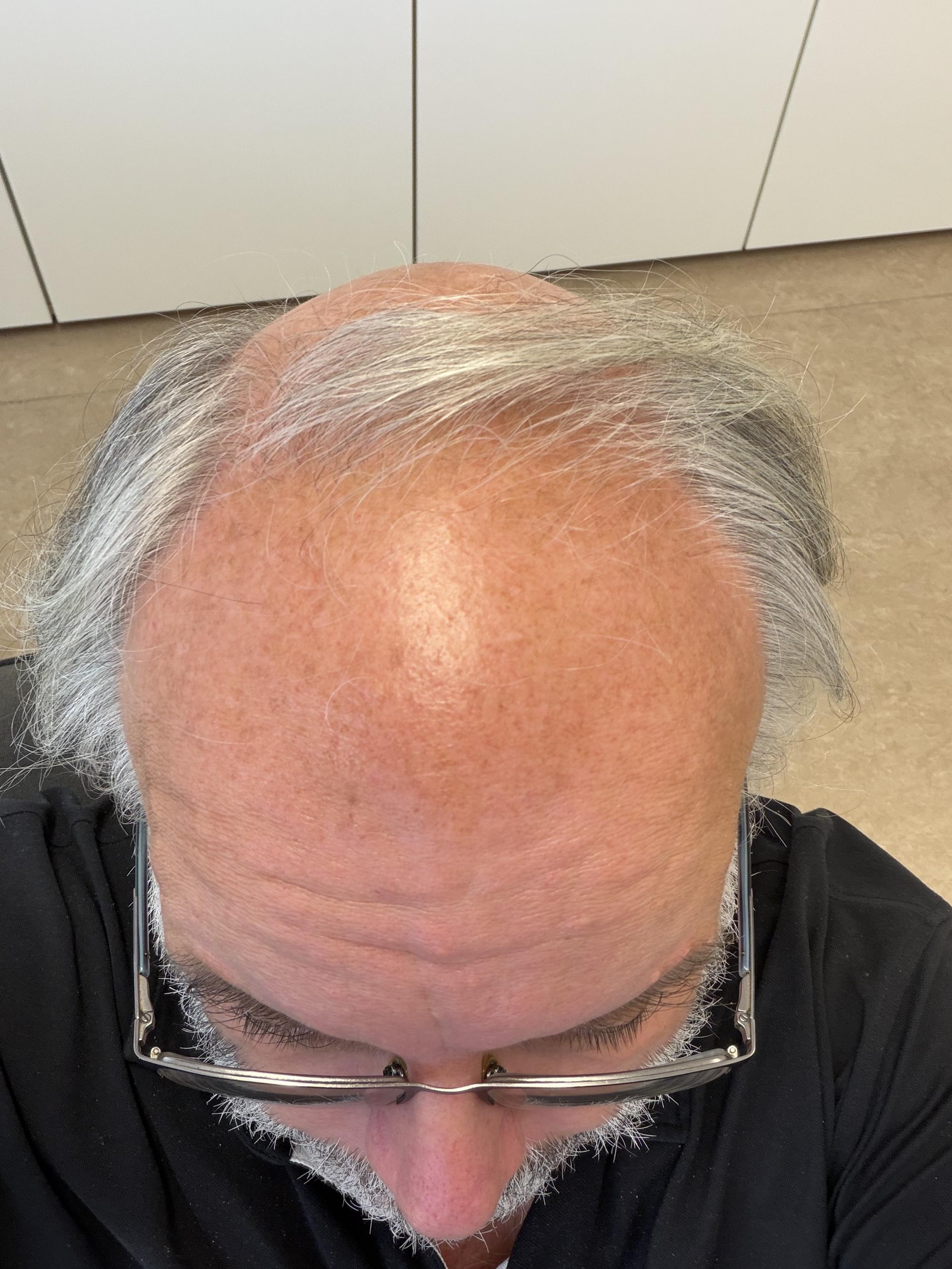 Roberts Kopf von oben fotografiert. Graues Haar und wenige davon am Vorderkopf. Freie Stirn. Trägt Brille. Hinter ihm sind weiße Kastentüren.